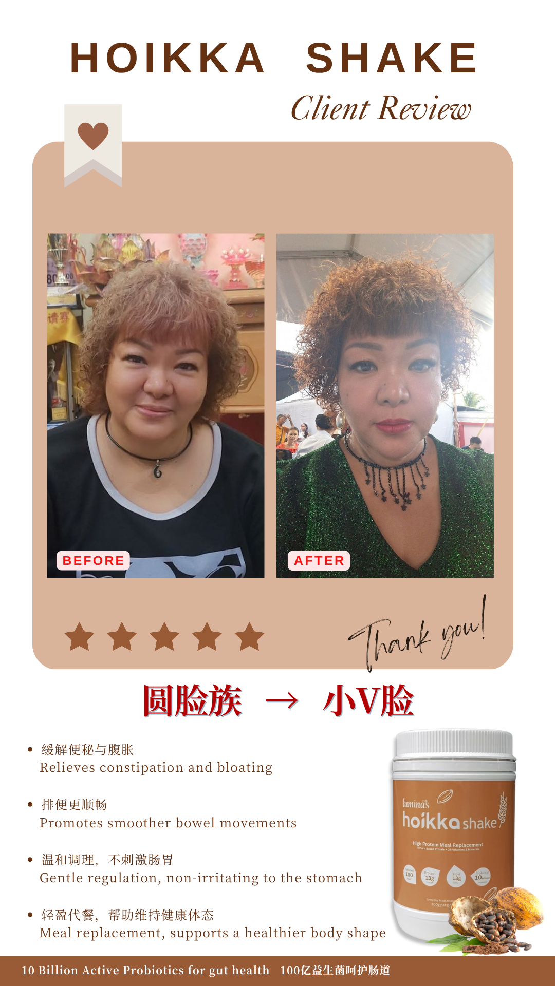 圆脸族 → 小V脸